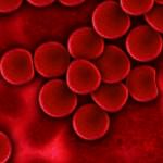anemia-jak-leczyc